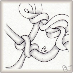 Muster B strin Q von Isabel Wallis, ein Muster geeignet für Zentangle® and Zentangle® inspired art, präsentiert in der Musterquelle